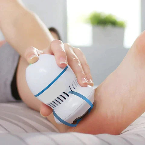 NexWell Vacuum Callus Remover